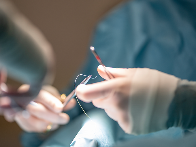 정맥류 근본 수술